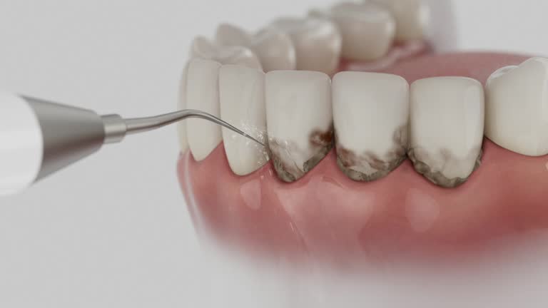 Trusted Wisdom Tooth Removal service in Genoa, AR - Dentist Open Now